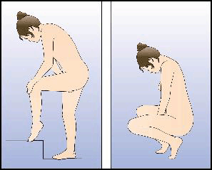 Nuvaring sistema de liberacion vaginal-figura3